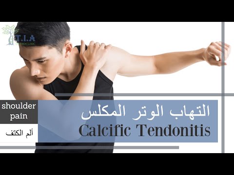 ماهو تكلس أوتار الكتف ( التهاب الوتر المكلس)    What is calcific tendonitis? (subtitled)