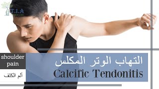 ماهو تكلس أوتار الكتف ( التهاب الوتر المكلس)    What is calcific tendonitis? (subtitled)