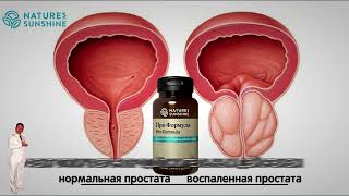 5 основных симптомов простатита.  Лучший продукт для здоровья простаты.  Про формула НСП.