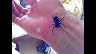 Black Widow Spider Bite Symptoms and Causes - Diagnosis - Treatment - Prevention