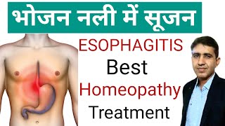 ESOPHAGITIS | भोजन नली में सूजन | Bhojan nali me jalan | Esophagitis Best Homeopathic Treatment screenshot 3