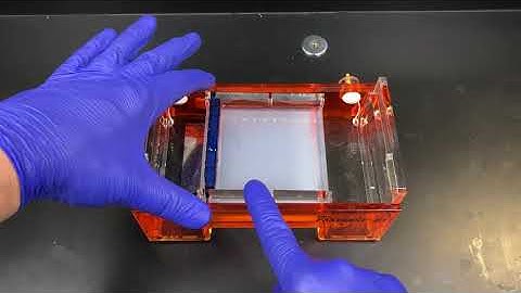 Agarose Gel Electrophoresis