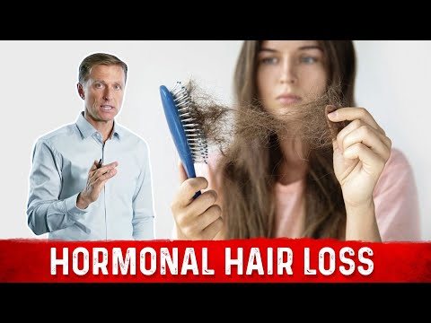 hormonal-hair-loss