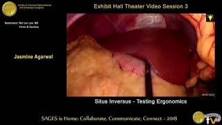 Download Lagu Situs inversus: Testing ergonomics MP3 Download Lagu Situs inversus: Testing ergonomics MP3