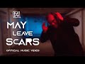 Major Moment May Leave Scars Official Music Video 