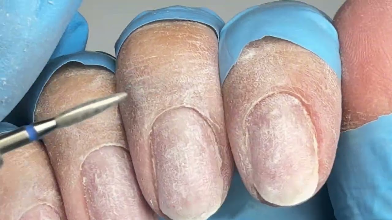 1 часть: Полное снятие ногтей #nails #наращиваниеногтей #маникюр #распаковкасалиэкспресс 