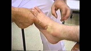 足関節の骨折 捻挫のそれぞれの症状 圧痛点 の違い Youtube