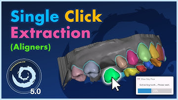 BSP5.0 Single Click Tooth Extraction for Aligner Cases!