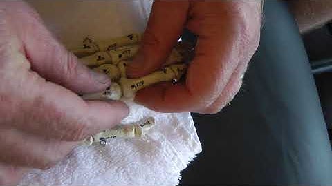 Page 94, 95 MCP Jt  Radial and Ulnar Glides