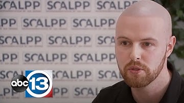 Scalp Micropigmentation Houston, TX ABC News - Best Scalp Micropigmentation Reviews | Scalpp Houston