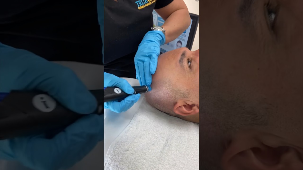 I tried a luxurious scalp facial 🧑‍🦲💧 | Keravive HydraFacial