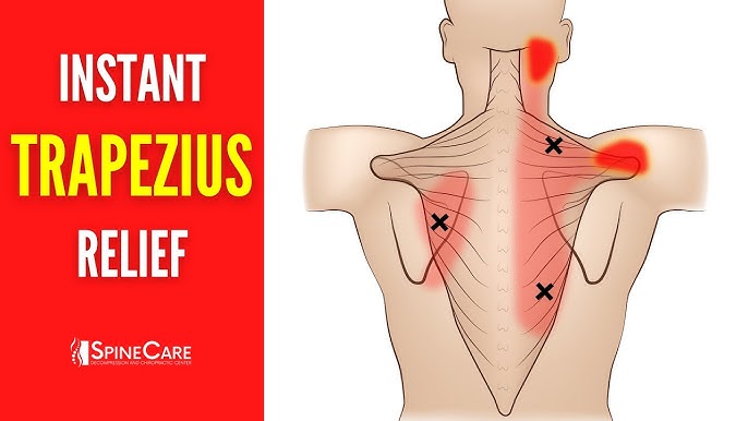 4 Ways to Loosen Your Trapezius Muscles - Sports Physiotherapy Melbourne  CBD & Clinical Pilates