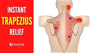 How to Relieve Trapezius Pain FOR GOOD