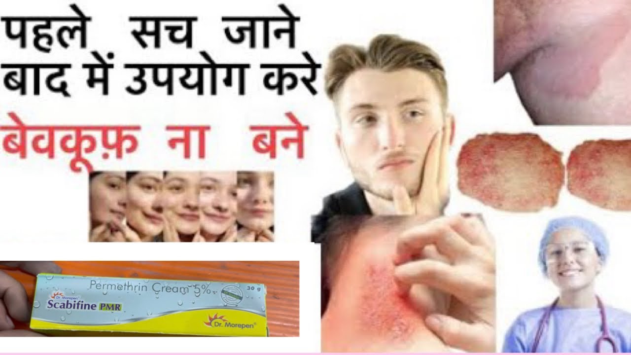 Scabifine PMR cream use , fungal infection daad khaj khujli ki dawa
