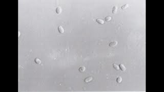 Download Lagu Preparing a Nosema Microscope Slide for analysis MP3