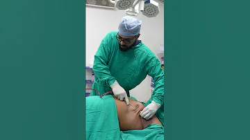 Gynecomastia Surgery | Gynecomastia Surgery cost | #shortvideo #shots