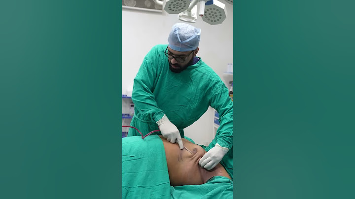 Gynecomastia Surgery | Gynecomastia Surgery cost | #shortvideo #shots