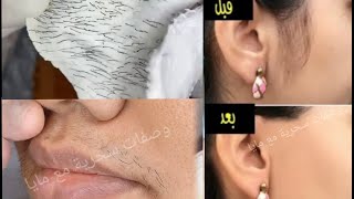 توقفي عن الحلاقة! هذه اسهل طريقة لإزالة شعر الوجه والجسم والعانة، سيسقط الشعر لوحده بدون ألم تفتيح