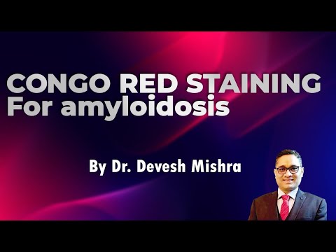 Congo red staining for Amyloidosis by Dr. Devesh Mishra