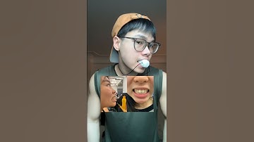 Hậu quả khi tập mewing sai cách