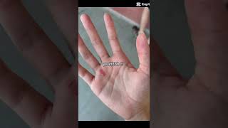 Tw - Blood Gymnastics Problems