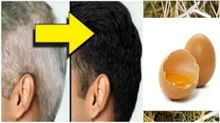 My 65 Years Father Applied Natural Dye Once A Week & Covered White Hair Permanently | White Hair Dye