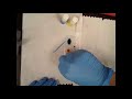 Blood typing demonstration