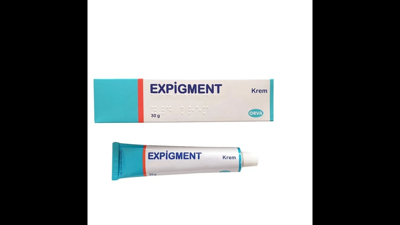 Expigment cream 4 hydroquinone melasma treatment