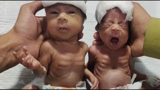 🍼 Premature Twin Babies Day 5 in NICU | Daily Condition Update \& Care Progress 🌸