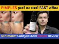 Minimalist Salicylic acid Serum | Salicylic acid serum for Acnes , Pimples &amp; Blackheads | Review
