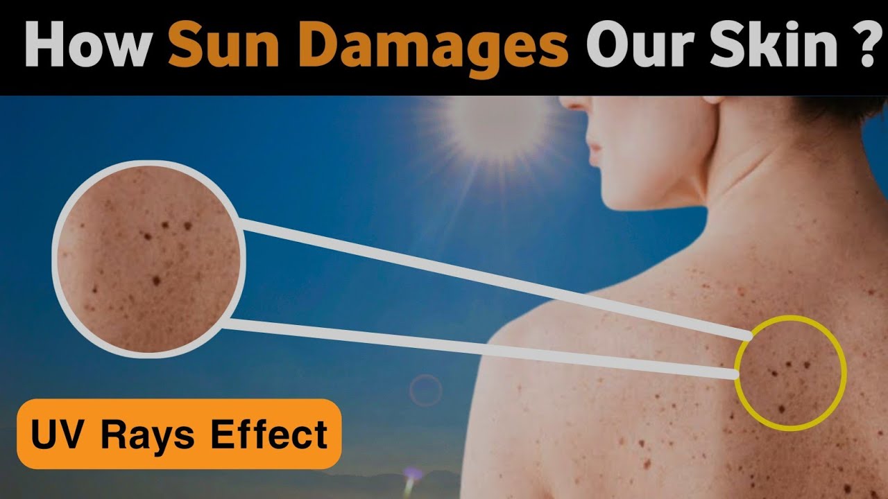 Sun Effect On Skin How Does The Sun Affect Your Skin YouTube Sun Effect On Skin How Does The Sun Affect Your Skin YouTube