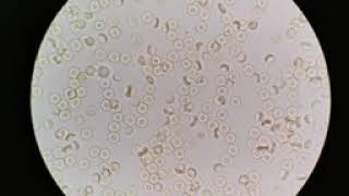 Red Blood Cells under the Microscope 400X and 1000X   Part 1