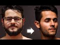 LOSE FACE FAT forever & get Jawline (1 SIMPLE SECRET) - हिन्दी