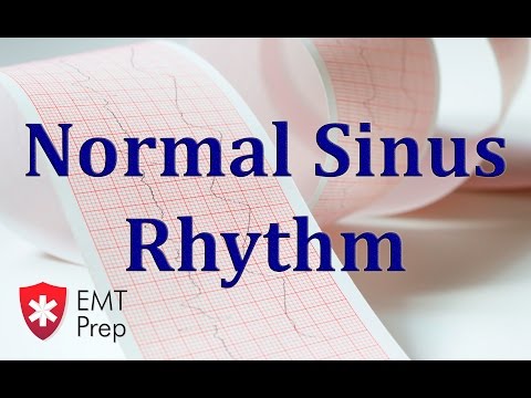 normal-sinus-rhythm-ecg---emtprep.com