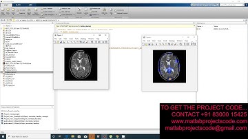 Multi-modality Medical Image Fusion Method in NSCT Domain