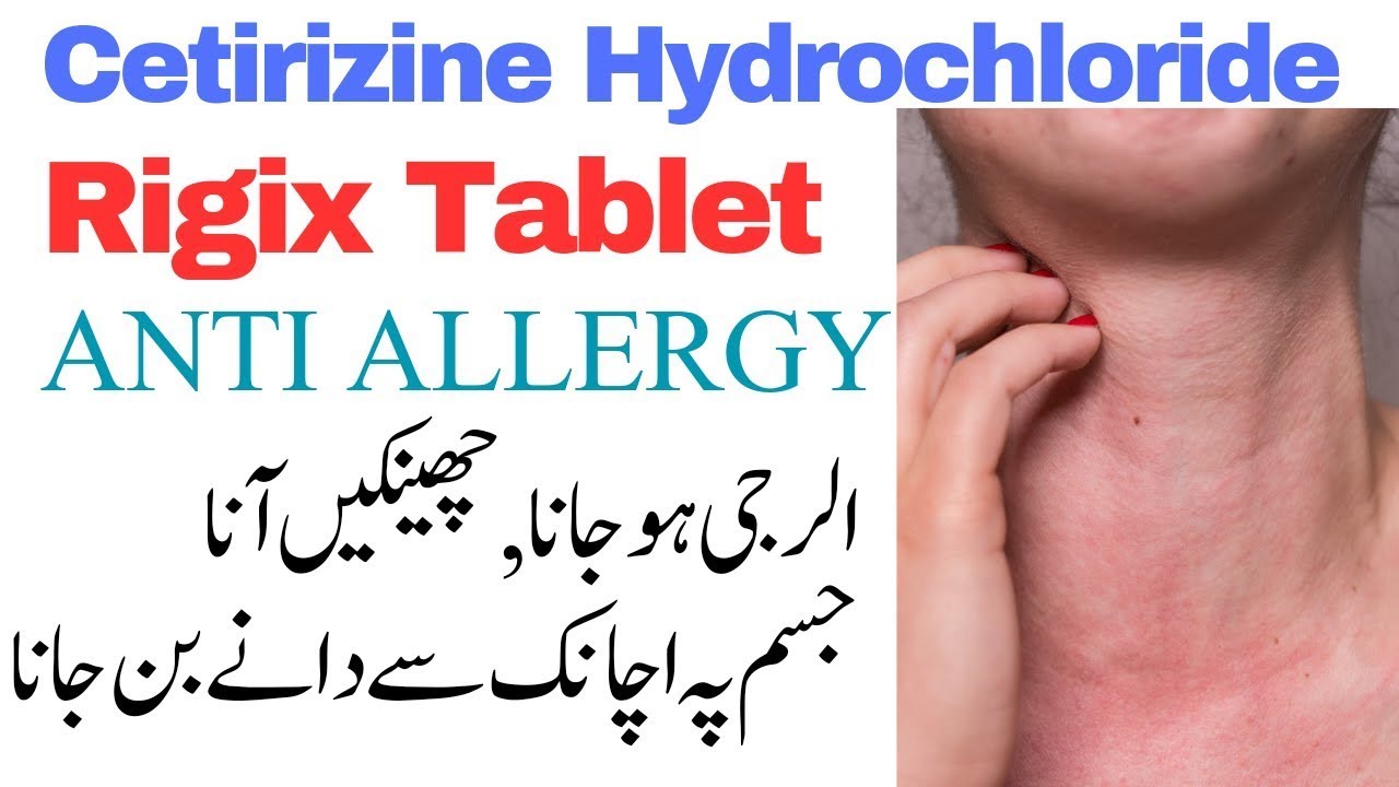 Cetirazine Rash Cetirizine hydrochloride|rigix tablet|rigix tablet uses in urdu|anti ...