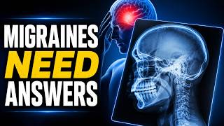 Why We Take X-Rays for Migraines | Chiropractor in Denver, CO