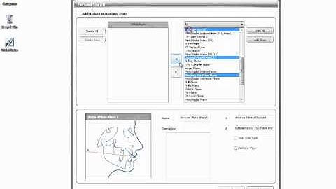 13  Managing Analysis Method For OrthoVision
