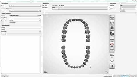 (Japanesse) Customized Abutment and a Crown Design