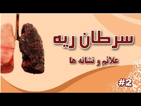 سرطان ریه آشنایی با کشنده ترین سرطان