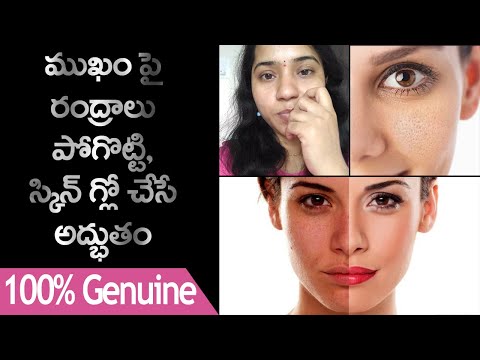 how-to-get-rid-of-large-open-pores-permanently-in-telugu-|-trendy-tips-and-talks-by-srinidhi