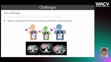 555 - Neural Contrast Enhancement of CT Image