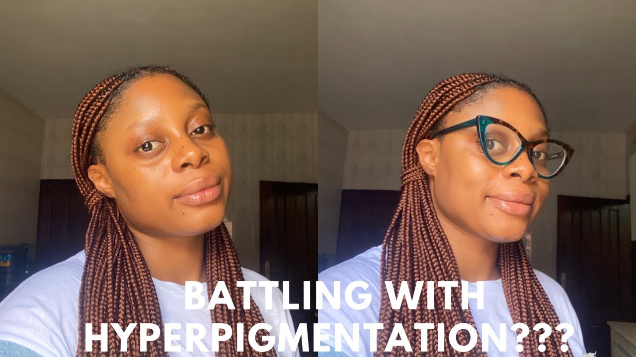 4 face Moisturizers that clear hyperpigmentation and illuminates the