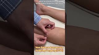 New Balance Acupuncture Reducing Fenglong St40