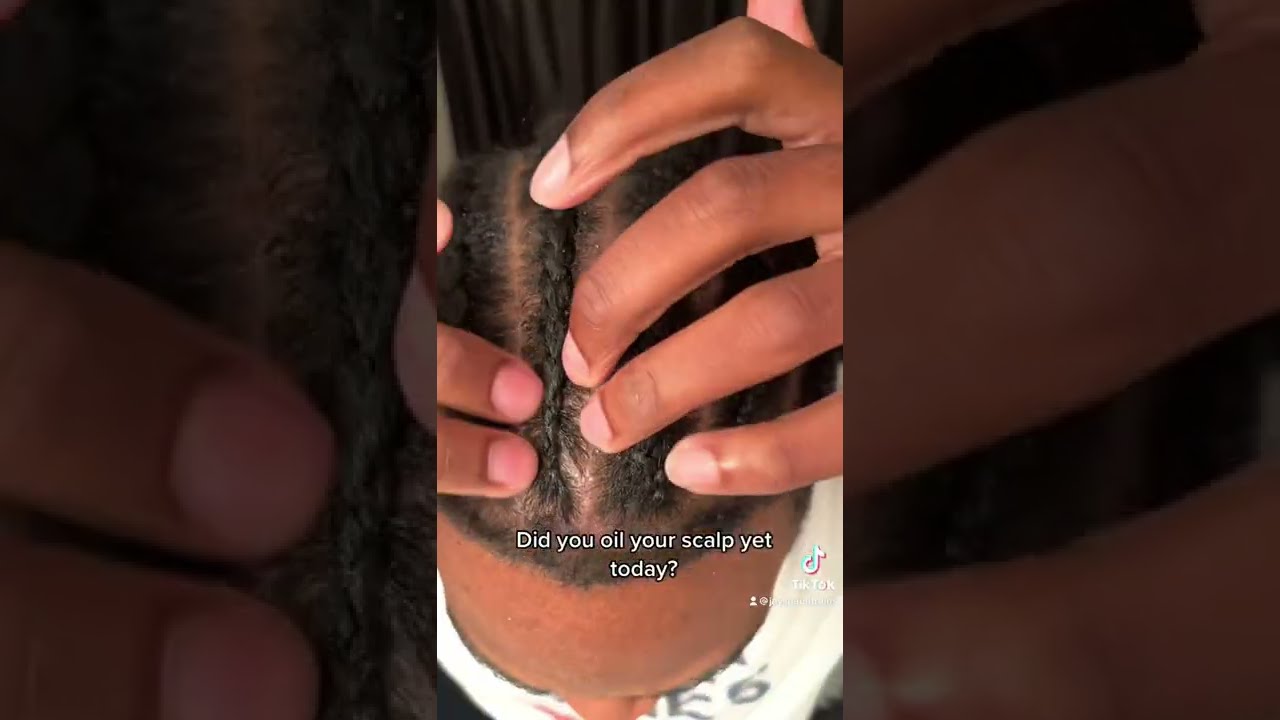 One Of The Reasons Your Scalp May Be Itching 