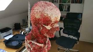 Real-Time Cinematic DICOM Rendering on HoloLens 2
