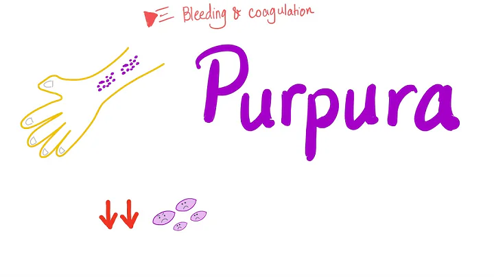 Pupura | Bleeding Disorders - DayDayNews