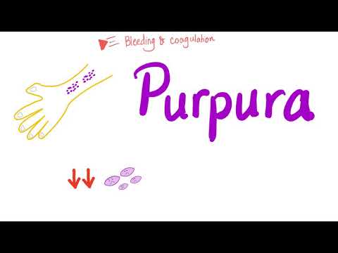 Video: Purpura - Types, Causes, Treatment