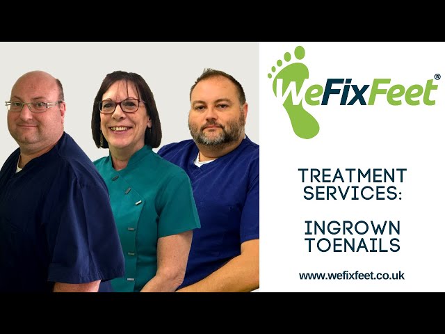 Common Foot Conditions - Ingrown Toenails - by We Fix Feet, Nottingham and Derbyshire Foot Health