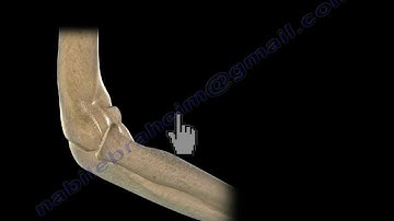 Radial Head Fracture- Everything You Need To Know- Dr. Nabil Ebraheim